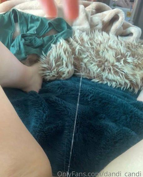 Dandi_candi nude leaked OnlyFans pic