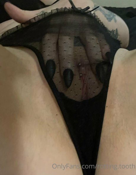 Rotting.tooth nude leaked OnlyFans pic