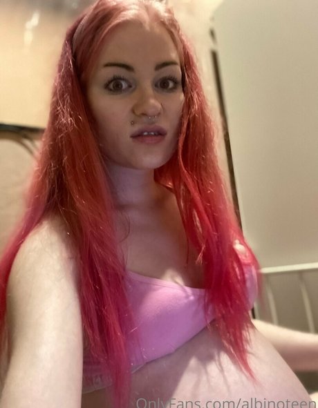 Albinoteen nude leaked OnlyFans pic
