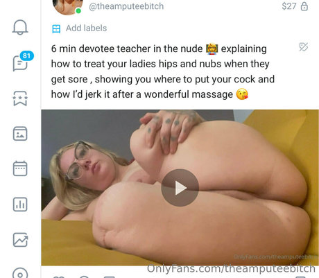 Theamputeebitch nude leaked OnlyFans photo #235