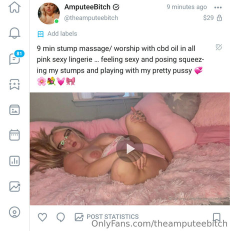 Theamputeebitch nude leaked OnlyFans photo #284